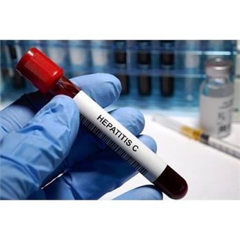 کرمانشاه پایلوت حذف «هپاتیت C» در گروه‌های پُرخطر شد