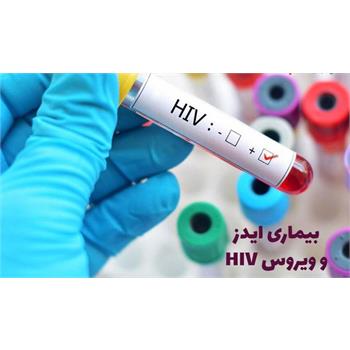 ابتلا به HIV جرم نیست؛ انجام تست اچ آی وی راهی برای ایمنی جامعه